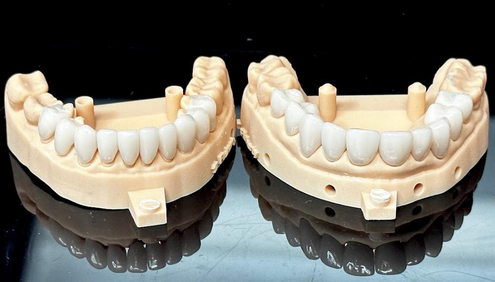 Veneers on display, scottsdale az