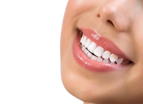 Close up of womans smile after composite bondings, scottsdale az