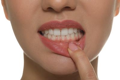 Woman pulling down lip, scottsdale az