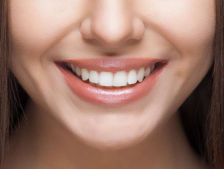 girl after teeth whitening in scottsdale