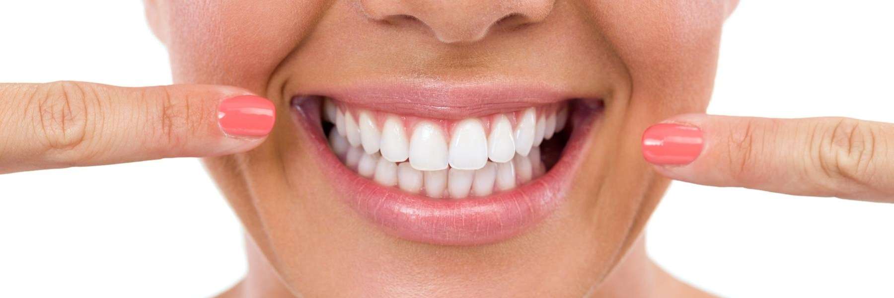 Womans smile after veneers, scottsdale az