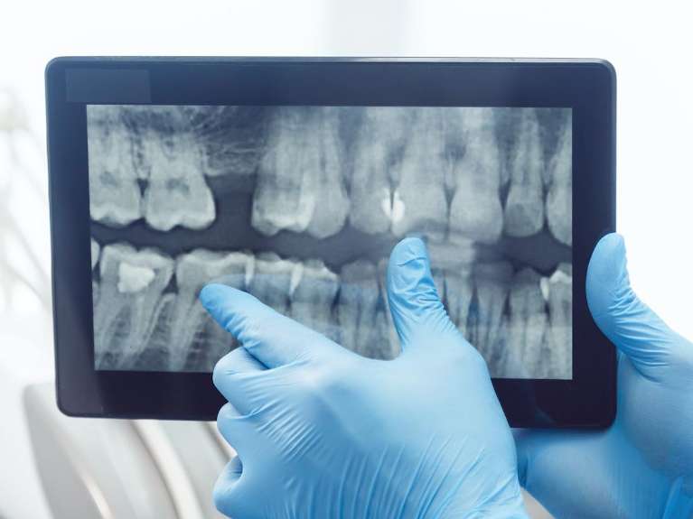 Digital x-rays on a tablet at scottsdale cosmetic dentistry