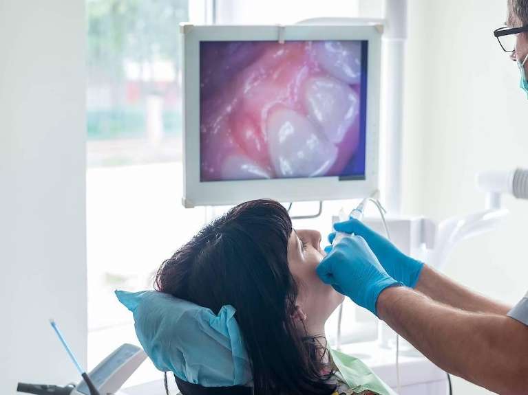 Intraoral Cameras being used on patient, scottsdale az