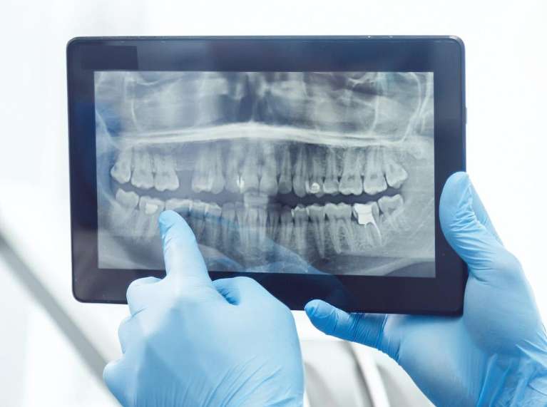 Panoramic X-Rays, scottsdale az